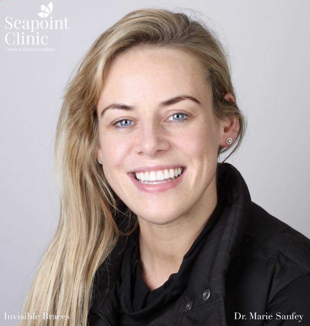 Invisalign