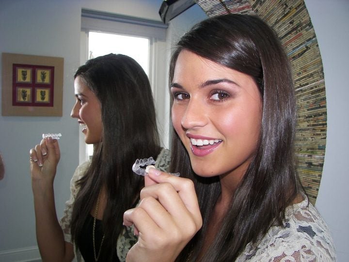invisalign
