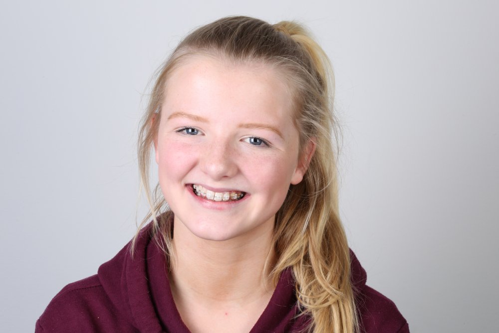 orthodontist dublin