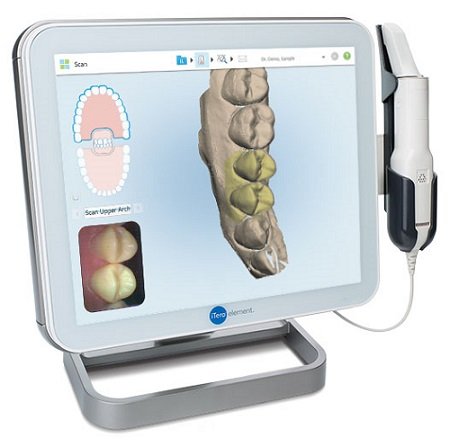 itero scanner