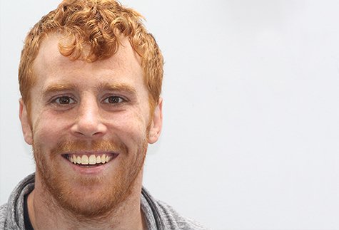 David Six Month Invisible Braces