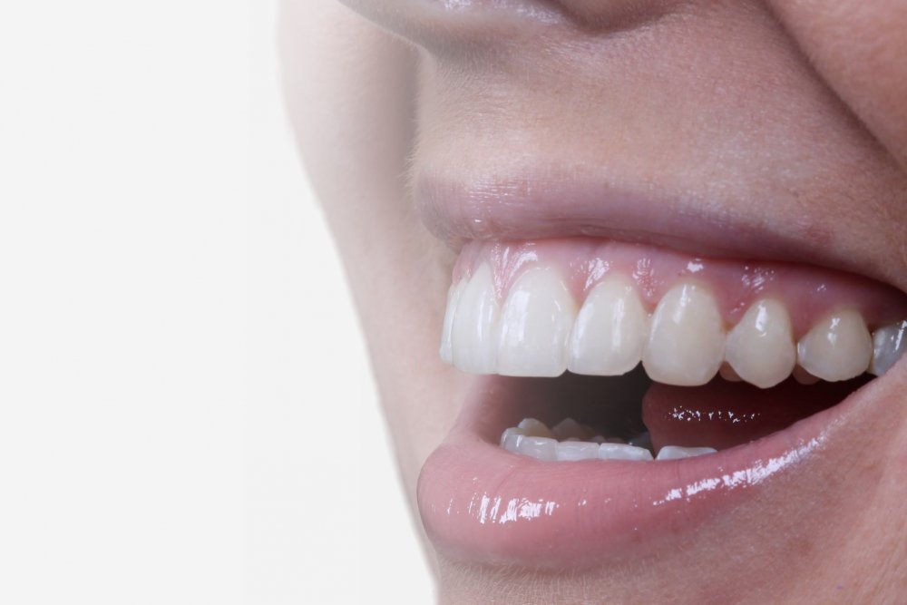 orthodontist, orthodontics, braces, seapoint clinic, straight teeth, orthodontist dublin, teen braces